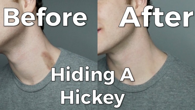 How To Cover A Hickey With Makeup